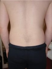 back of human body